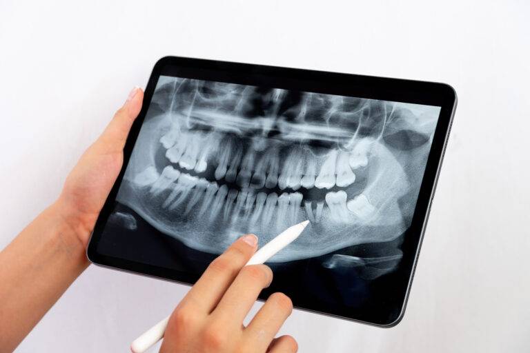 radiografía dental