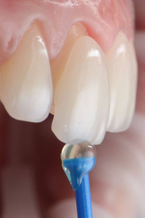 ESTETICA DENTAL