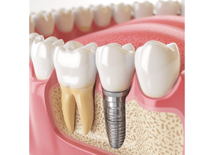 cirugia oral redimension 2