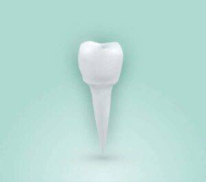 Endodoncia Uniradicular