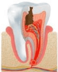 Odontología conservadora 3