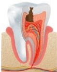 Odontología conservadora